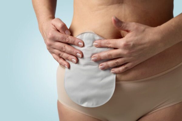 Ostomia